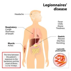 legionella
